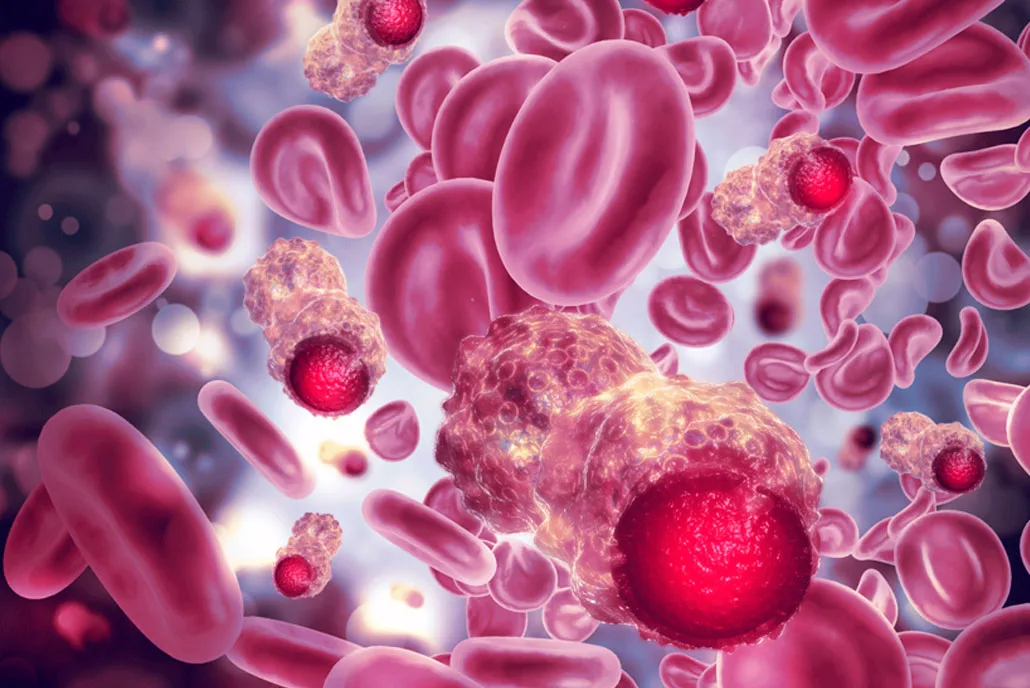 IMDELLTRA: Aprovada para tratamento de Cânceres Hematológicos