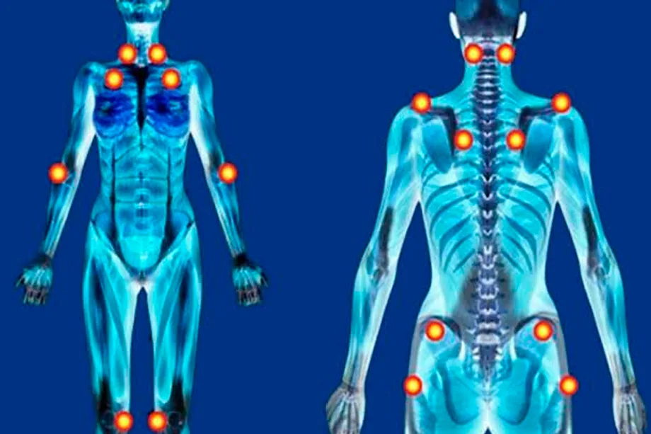Nova Lei Reconhece Fibromialgia como Deficiência em Todo Brasil